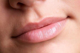 Wie Man Kaputte Lippen Kuriert Fur Real